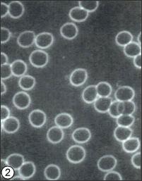 Dispersed Cells